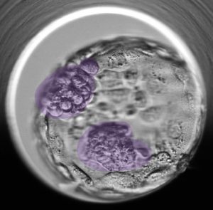 Cuantos embriones se pueden transferir